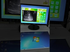 固定波源 身体外ショック波 リトトリプシー装置 超音波定位システム