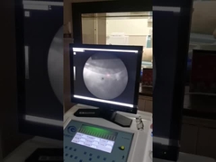 高精度な体外衝撃波装置 衝撃速度のリトリプシーX線システム