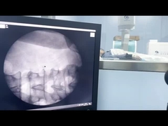 高周波外体ショック波装置 フォーカスアプリケーション 1-16Hz 100W